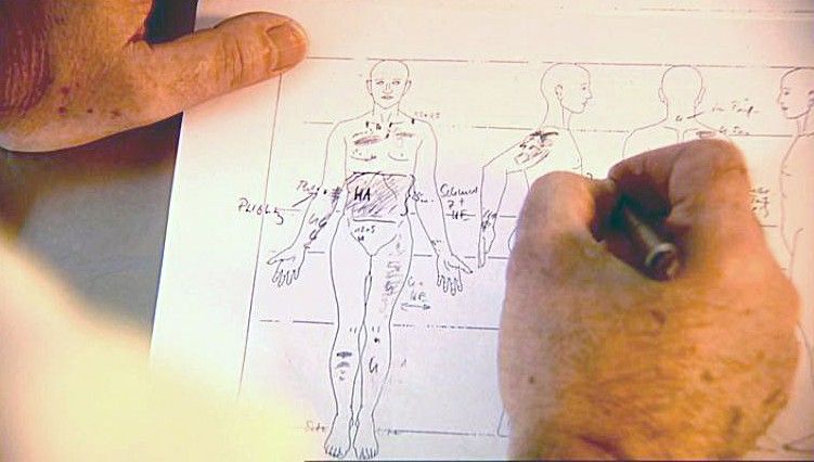 Anwälte der Toten - Rechtsmediziner decken auf