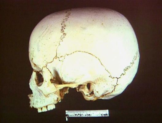 Medical Detectives - Geheimnisse der Gerichtsmedizin