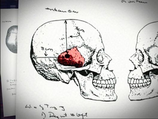 Medical Detectives - Geheimnisse der Gerichtsmedizin